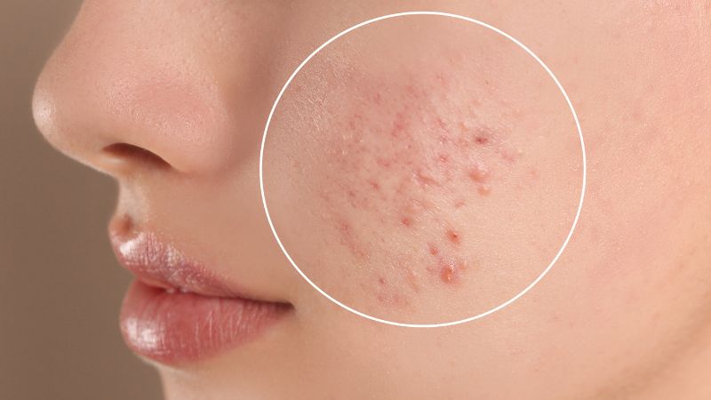 xr:d:daffil2rkjg:3075,j:2598981593563864809,t:23100105